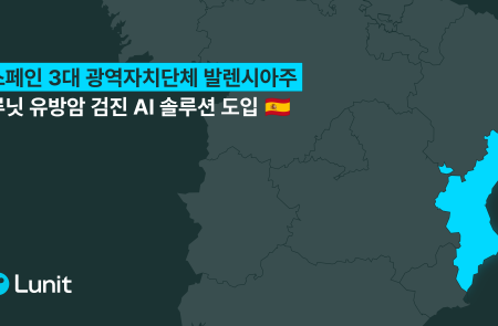 루닛, 스페인 발렌시아주 ‘국가 유방암 검진사업’ 단독 수주
